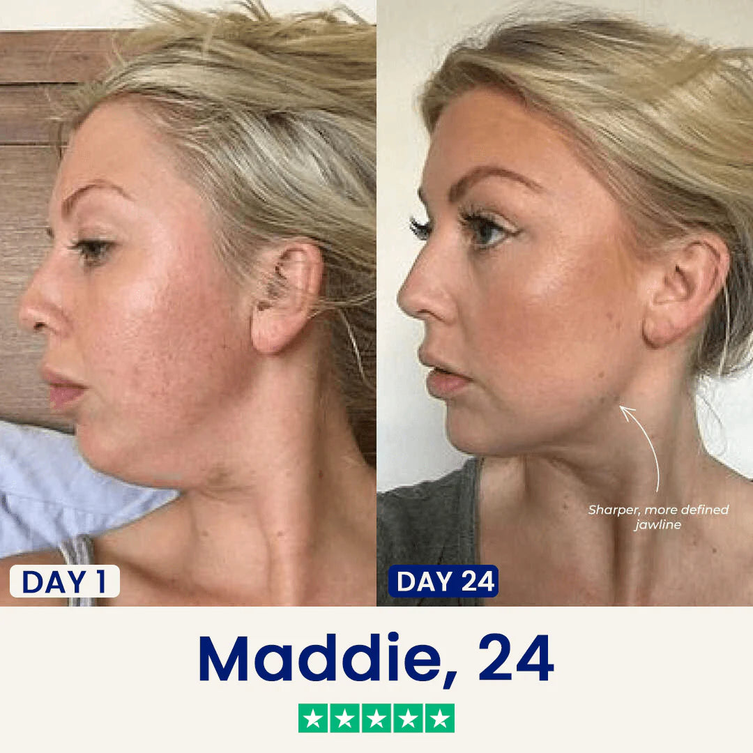 Slimora™ Chin Fat Reducer Mask