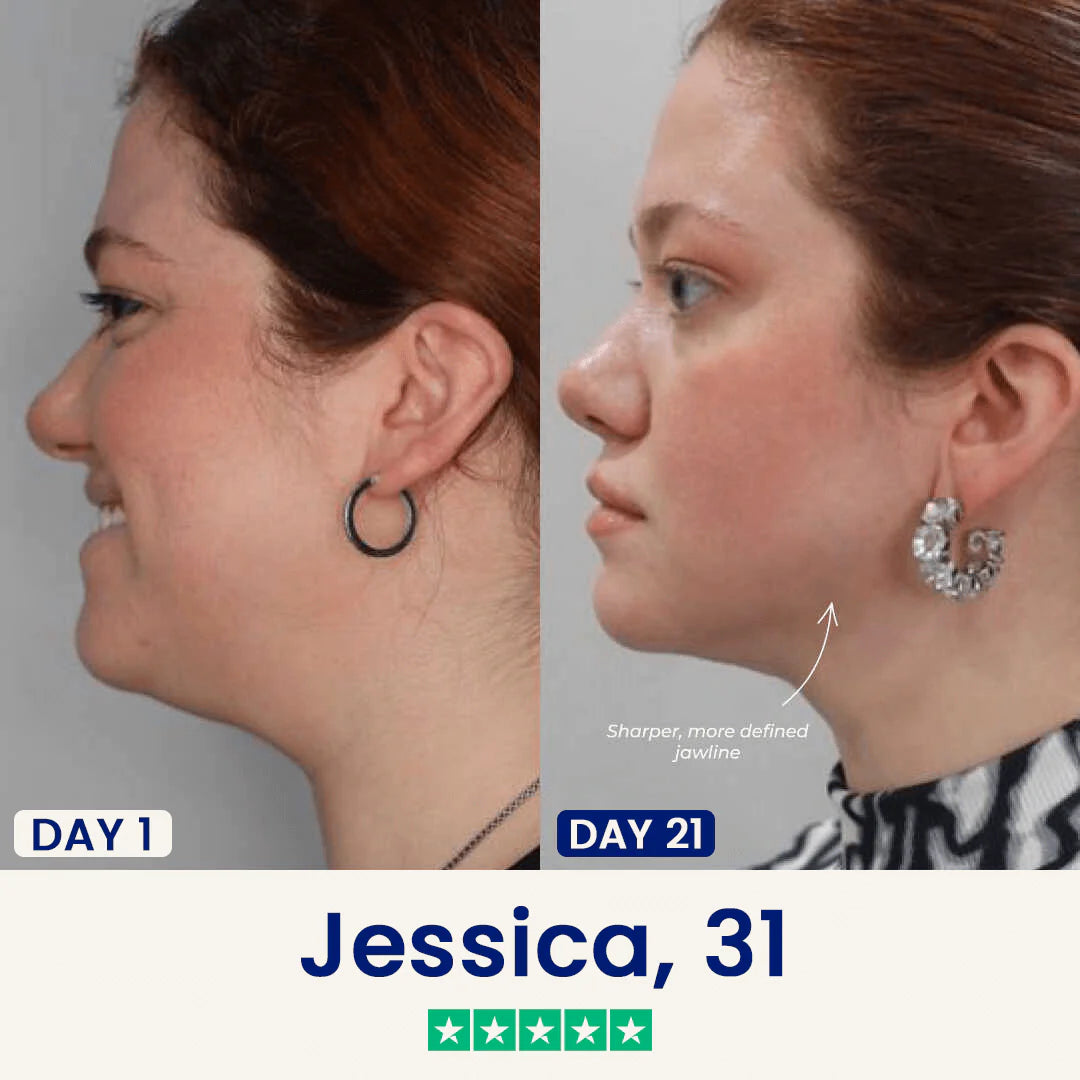 Slimora™ Chin Fat Reducer Mask