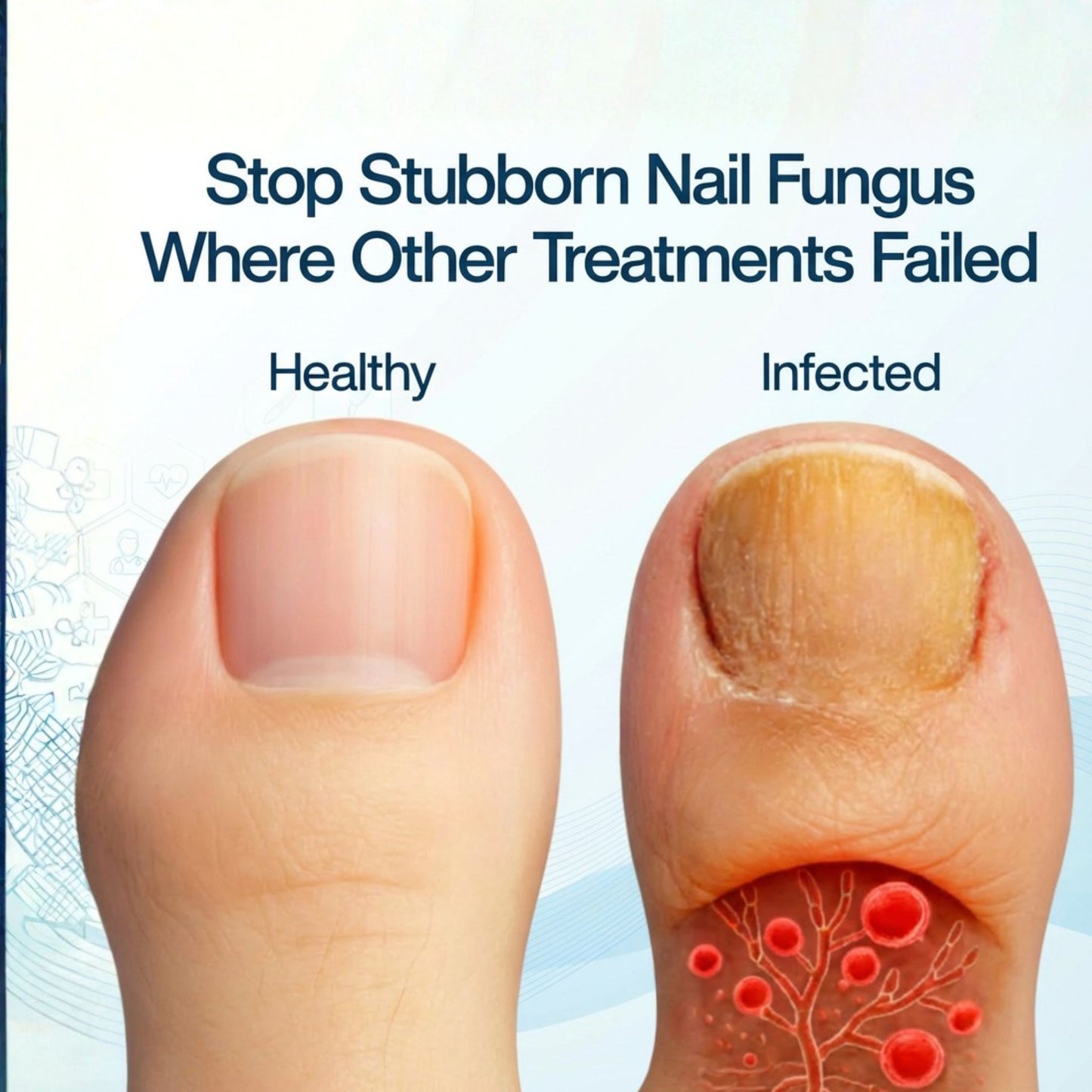 Comfort Cloud™ Nail Antifungal Pen