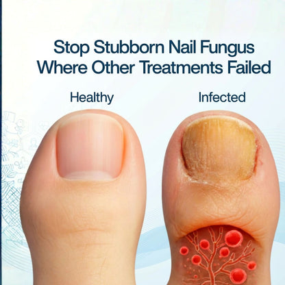 Comfort Cloud™ Nail Antifungal Pen