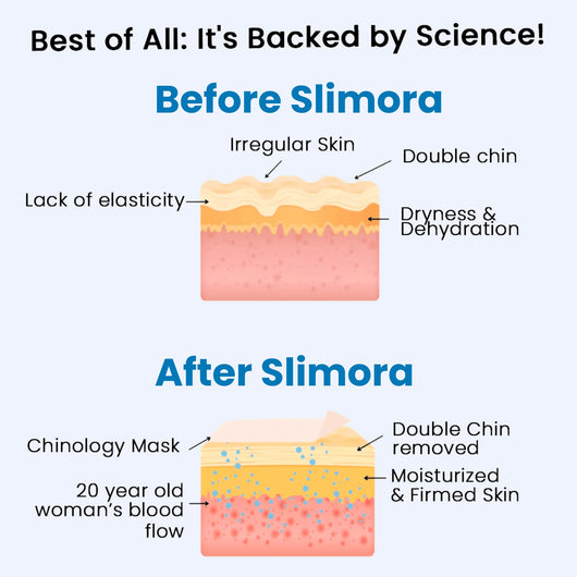 Slimora™ Chin Fat Reducer Mask