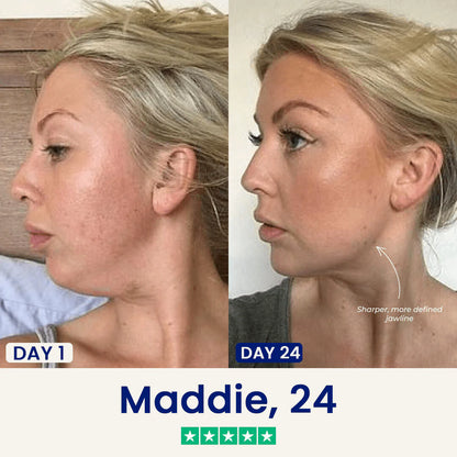 Slimora™ Chin Fat Reducer Mask