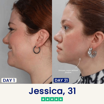 Slimora™ Chin Fat Reducer Mask