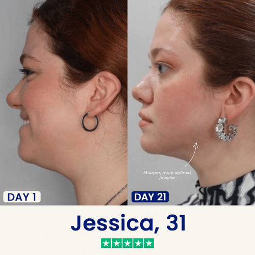 Slimora™ Chin Fat Reducer Mask