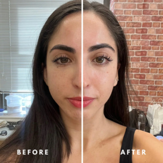 Lymphatic Face Brush